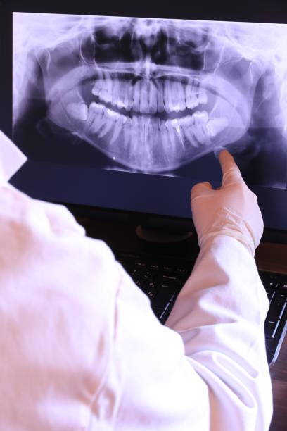 Best Emergency Root Canal Treatment in Whitesboro, NJ