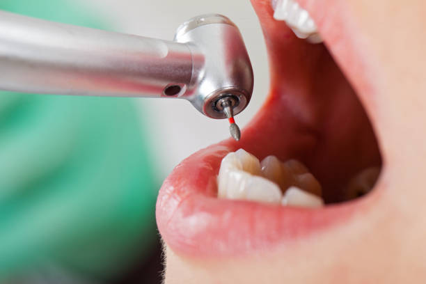 Best Emergency Dental Services for Seniors in Whitesboro, NJ